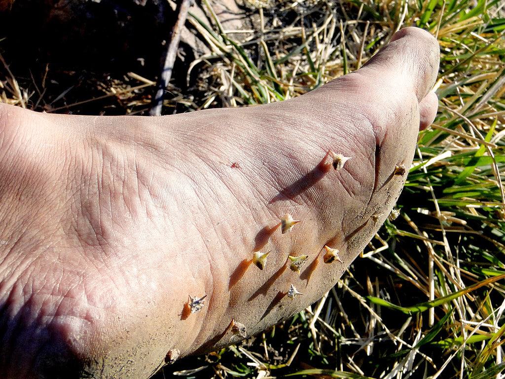 Bindi prickles in lawn